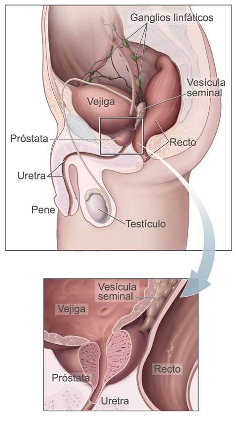 Cirujano especializado en prostata